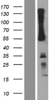 IKZF3 / AIOLOS Protein - Western validation with an anti-DDK antibody * L: Control HEK293 lysate R: Over-expression lysate