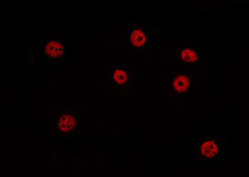 IKZF4 / EOS Antibody - Staining HepG2 cells by IF/ICC. The samples were fixed with PFA and permeabilized in 0.1% Triton X-100, then blocked in 10% serum for 45 min at 25°C. The primary antibody was diluted at 1:200 and incubated with the sample for 1 hour at 37°C. An Alexa Fluor 594 conjugated goat anti-rabbit IgG (H+L) Ab, diluted at 1/600, was used as the secondary antibody.