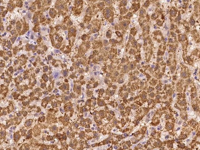 IKZF4 / EOS Antibody - Immunochemical staining of human IKZF4 in human liver with rabbit polyclonal antibody at 1:100 dilution, formalin-fixed paraffin embedded sections.