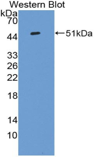 IL-10 Antibody - Western blot of recombinant IL10.