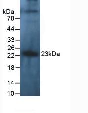 IL-10 Antibody - Western Blot; Sample: Human Leukocyte Cells.