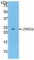 IL-10 Antibody - Western Blot; Sample: Recombinant IL10, Human.