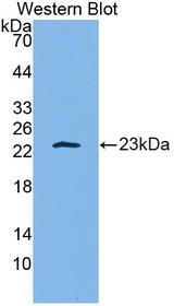 IL-10 Antibody - Western Blot; Sample: Recombinant protein.