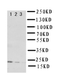 IL-10 Antibody - WB of IL10 antibody. Lane 1: Recombinant Rat IL10 Protein 10ng. Lane 2: Recombinant Rat IL10 Protein 5ng. Lane 3: Recombinant Rat IL10 Protein 2.5ng..