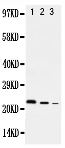 IL-10 Antibody - Anti-rat IL-10 antibody, Western blotting Lane 1: Recombinant Rat IL-10 Protein 10ng Lane 2: Recombinant Rat IL-10 Protein 5ng Lane 3: Recombinant Rat IL-10 Protein 2