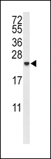 IL-10 Antibody - Western blot of IL10 Antibody in MDA-MB435 cell line lysates (35 ug/lane). IL10 (arrow) was detected using the purified antibody.