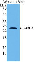 IL-10 Antibody - Western Blot; Sample: Recombinant IL10, Human.