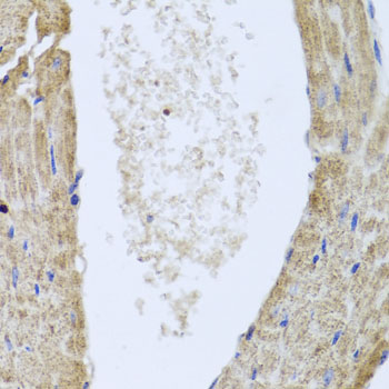 IL-10 Antibody - Immunohistochemistry of paraffin-embedded mouse heart.