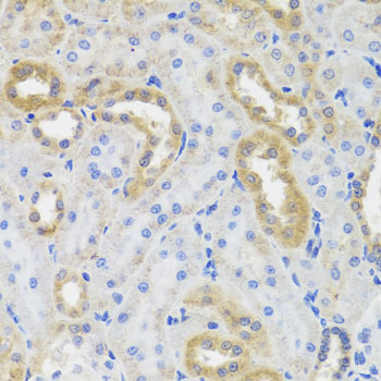 IL-10 Antibody - Immunohistochemistry of paraffin-embedded rat kidney tissue.