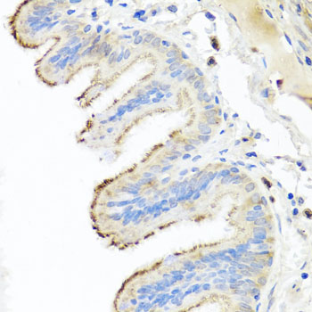 IL-10 Antibody - Immunohistochemistry of paraffin-embedded human trachea tissue.