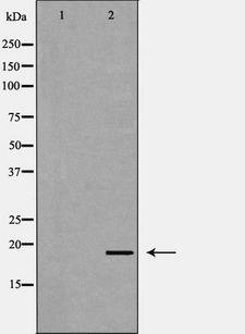IL-10 Antibody - Western blot analysis of extracts of jk2 line using IL10 antibody. The lane on the left is treated with the antigen-specific peptide.