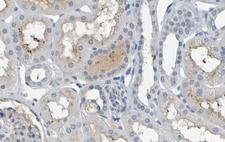 IL-10 Antibody - 1/100 staining human kidney tissue by IHC-P. The sample was formaldehyde fixed and a heat mediated antigen retrieval step in citrate buffer was performed. The sample was then blocked and incubated with the antibody for 1.5 hours at 22°C. An HRP conjugated goat anti-rabbit antibody was used as the secondary antibody.