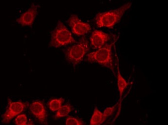IL-10 Antibody - Staining HepG2 cells by IF/ICC. The samples were fixed with PFA and permeabilized in 0.1% Triton X-100, then blocked in 10% serum for 45 min at 25°C. The primary antibody was diluted at 1:200 and incubated with the sample for 1 hour at 37°C. An Alexa Fluor 594 conjugated goat anti-rabbit IgG (H+L) Ab, diluted at 1/600, was used as the secondary antibody.