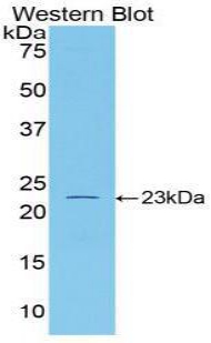 IL-1B / IL-1 Beta Antibody - Western blot of recombinant IL1B.  This image was taken for the unconjugated form of this product. Other forms have not been tested.