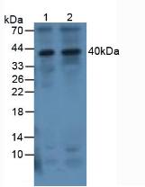 IL-1B / IL-1 Beta Antibody - Western Blot; Sample. Lane1: Human 293T Cells; Lane2: Human Jurkat Cells.