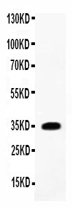 IL-1B / IL-1 Beta Antibody - WB of IL1B antibody. All lanes: Anti-IL1 beta at 0.5ug/ml. WB: Rat Testis Tissue Lysate at 40ug. Predicted bind size: 31KD. Observed bind size: 35KD.