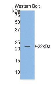 IL-1B / IL-1 Beta Antibody - Western blot of IL-1B / IL-1 Beta antibody.