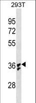 IL-1B / IL-1 Beta Antibody - IL1B Antibody (Ascites). 293 cell lysates transiently transfected with the IL1B gene.