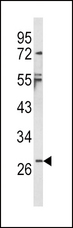 IL-1B / IL-1 Beta Antibody - Western blot of IL1B Antibody in NCI-H460 cell line lysates (35 ug/lane). IL1B (arrow) was detected using the purified antibody.