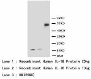 IL-1B / IL-1 Beta Antibody