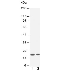 IL-1B / IL-1 Beta Antibody - Western blot testing of IL1 beta antibody and Lane 1: recombinant human protein 20ng; 2: 10ng