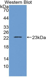 IL-1B / IL-1 Beta Antibody - Western blot of recombinant IL1B.