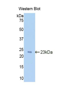 IL-1B / IL-1 Beta Antibody - Western blot of recombinant IL1B.  This image was taken for the unconjugated form of this product. Other forms have not been tested.