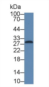 IL-1B / IL-1 Beta Antibody