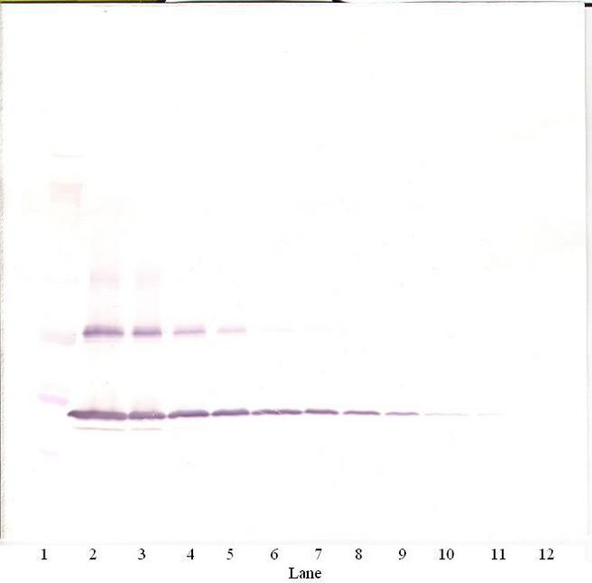 IL-1B / IL-1 Beta Antibody - Western Blot (non-reducing) of IL1B / IL-1 Beta antibody. This image was taken for the unconjugated form of this product. Other forms have not been tested.