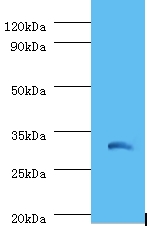 IL-1B / IL-1 Beta Antibody - Western blot of Interleukin-1 beta antibody at 2 ug/ml with recombinant Interleukin-1 beta protein 0.01 ug.  This image was taken for the unconjugated form of this product. Other forms have not been tested.