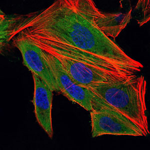 IL-1B / IL-1 Beta Antibody - Immunofluorescence of HepG2 cells using IL1B mouse monoclonal antibody (green). Blue: DRAQ5 fluorescent DNA dye. Red: Actin filaments have been labeled with Alexa Fluor-555 phalloidin.