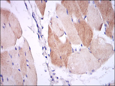 IL-1B / IL-1 Beta Antibody - IHC of paraffin-embedded muscle tissues using IL1B mouse monoclonal antibody with DAB staining.