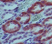 IL-1B / IL-1 Beta Antibody - Immunohistochemistry-Paraffin: IL1 beta Antibody (43N3D8) - analysis of Interleukin-1 beta in human kidney tissue using Interleukin-1 beta antibody at 5 ug/ml.  This image was taken for the unconjugated form of this product. Other forms have not been tested.
