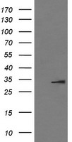 IL-1B / IL-1 Beta Antibody - HEK293T cells were transfected with the pCMV6-ENTRY control (Left lane) or pCMV6-ENTRY IL1B (Right lane) cDNA for 48 hrs and lysed. Equivalent amounts of cell lysates (5 ug per lane) were separated by SDS-PAGE and immunoblotted with anti-IL1B.