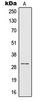 IL-1B / IL-1 Beta Antibody - Western blot analysis of IL-1 beta expression in THP1 (A) whole cell lysates.