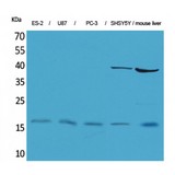 IL-1B / IL-1 Beta Antibody - Western blot of IL-1beta antibody