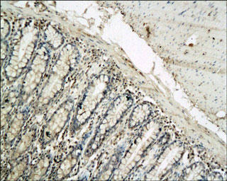 IL-1B / IL-1 Beta Antibody - IL-1 beta staining in rat colon. Paraffin-embedded rat colon is stained with IL-1 beta Antibody used at 1:100 dilution.