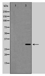 IL-1B / IL-1 Beta Antibody - Western blot of Interleukin?1 beta expression in HeLa cell lysate