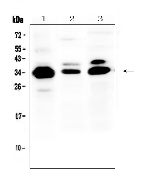 IL-1B / IL-1 Beta Antibody - Western blot analysis of IL-1 beta using anti-IL-1 beta antibody. Electrophoresis was performed on a 5-20% SDS-PAGE gel at 70V (Stacking gel) / 90V (Resolving gel) for 2-3 hours. The sample well of each lane was loaded with 50ug of sample under reducing conditions. Lane 1: human COLO-320 whole cell lysate,Lane 2: rat spleen tissue lysate,Lane 3: mouse NIH3T3 whole cell lysate. After Electrophoresis, proteins were transferred to a Nitrocellulose membrane at 150mA for 50-90 minutes. Blocked the membrane with 5% Non-fat Milk/ TBS for 1.5 hour at RT. The membrane was incubated with rabbit anti-IL-1 beta antigen affinity purified polyclonal antibody at 0.5 µg/mL overnight at 4°C, then washed with TBS-0.1% Tween 3 times with 5 minutes each and probed with a goat anti-rabbit IgG-HRP secondary antibody at a dilution of 1:10000 for 1.5 hour at RT. The signal is developed using an Enhanced Chemiluminescent detection (ECL) kit with Tanon 5200 system. A specific band was detected for IL-1 beta at approximately 35KD. The expected band size for IL-1 beta is at 31KD.