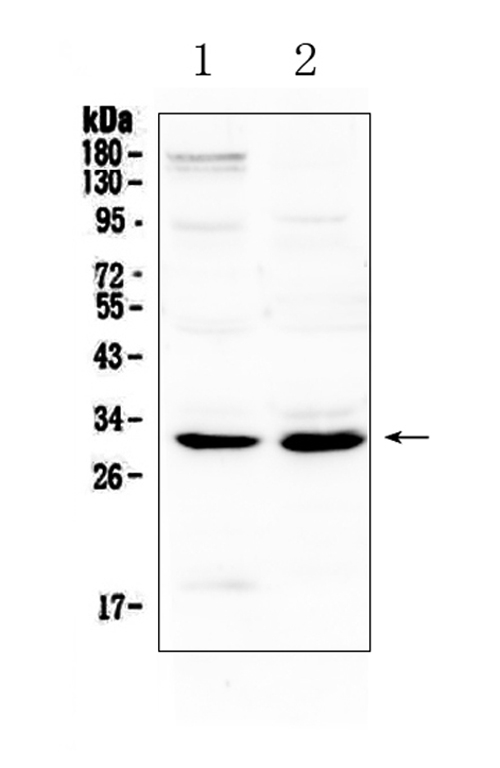 IL-1B / IL-1 Beta Antibody - Western blot analysis of IL1 beta using anti-IL1 beta antibody. Electrophoresis was performed on a 5-20% SDS-PAGE gel at 70V (Stacking gel) / 90V (Resolving gel) for 2-3 hours. The sample well of each lane was loaded with 50ug of sample under reducing conditions. Lane 1: rat brain tissue lysates,Lane 2: mouse spleen tissue lysates. After Electrophoresis, proteins were transferred to a Nitrocellulose membrane at 150mA for 50-90 minutes. Blocked the membrane with 5% Non-fat Milk/ TBS for 1.5 hour at RT. The membrane was incubated with rabbit anti-IL1 beta antigen affinity purified polyclonal antibody at 0.5 µg/mL overnight at 4°C, then washed with TBS-0.1% Tween 3 times with 5 minutes each and probed with a goat anti-rabbit IgG-HRP secondary antibody at a dilution of 1:10000 for 1.5 hour at RT. The signal is developed using an Enhanced Chemiluminescent detection (ECL) kit with Tanon 5200 system. A specific band was detected for IL1 beta at approximately 31KD. The expected band size for IL1 beta is at 31KD.