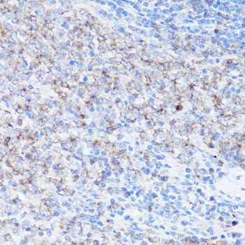 IL-1B / IL-1 Beta Antibody - Immunohistochemistry of paraffin-embedded rat spleen using IL1B antibody at dilution of 1:150 (40x lens).