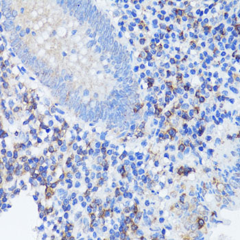 IL-1B / IL-1 Beta Antibody - Immunohistochemistry of paraffin-embedded human appendix using IL1B antibody at dilution of 1:150 (40x lens).