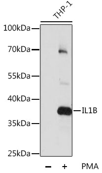 IL-1B / IL-1 Beta Antibody - Western blot analysis of extracts of various cell lines, using IL1B antibody at 1:1000 dilution. THP-1 cells were treated by PMA (80 nM) for overnight. The secondary antibody used was an HRP Goat Anti-Rabbit IgG (H+L) at 1:10000 dilution. Lysates were loaded 25ug per lane and 3% nonfat dry milk in TBST was used for blocking. An ECL Kit was used for detection and the exposure time was 5s.