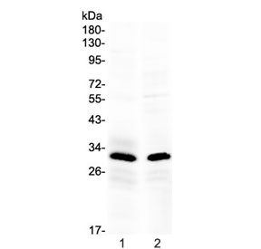 IL-1B / IL-1 Beta Antibody - Western blot testing of 1) mouse spleen and 2) human PANC-1 lysate with IL1B antibody at 0.5ug/ml. Predicted molecular weight ~31 kDa.