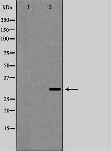 IL-1B / IL-1 Beta Antibody - Western blot analysis of Interleukin 1Beta expression in HeLa cells lysate. The lane on the left is treated with the antigen-specific peptide.