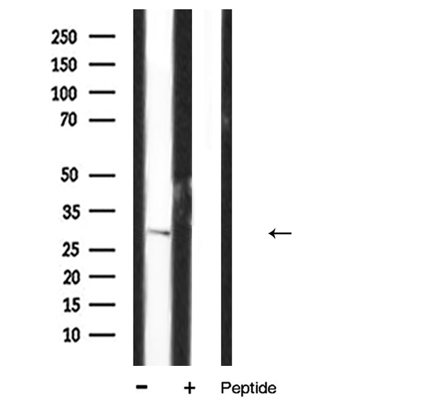 IL-1B / IL-1 Beta Antibody - Western blot analysis of Interleukin 1Beta expression in S3 lysate