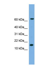 IL-1B / IL-1 Beta Antibody - IL1B / IL1 Beta antibody Western blot of HeLa lysate. This image was taken for the unconjugated form of this product. Other forms have not been tested.
