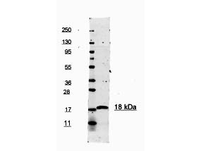 IL-1B / IL-1 Beta Antibody - Anti-Human IL-1beta Antibody - Western Blot. This antibody is primarily directed against mature, 17000 MW human IL-1beta and is useful in determining its presence in various assays.