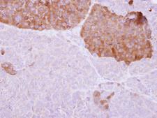 IL-22BP / IL22RA2 Antibody - IL22 Receptor alpha 2 antibody detects IL22RA2 protein at cytosol on PC14 xenograft by immunohistochemical analysis. Sample: Paraffin-embedded PC14 xenograft . IL22 Receptor alpha 2 antibody dilution:1:250.