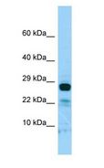 IL-22BP / IL22RA2 Antibody - IL-22BP / IL22RA2 antibody Western Blot of RPMI-8226.  This image was taken for the unconjugated form of this product. Other forms have not been tested.